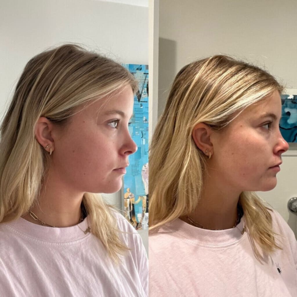 Lumivella Gezichtsverstevigend Masker