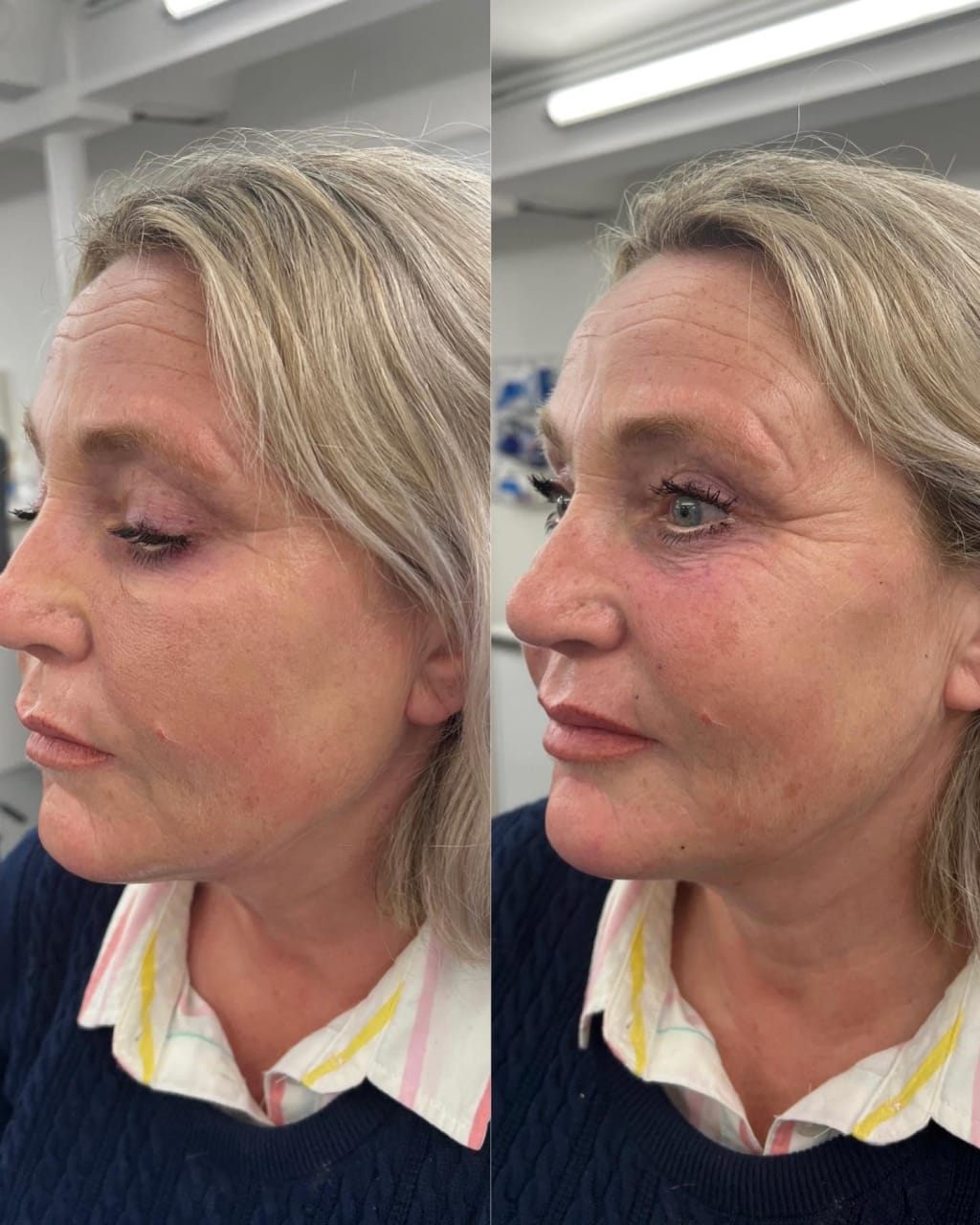 Lumivella Gezichtsverstevigend Masker
